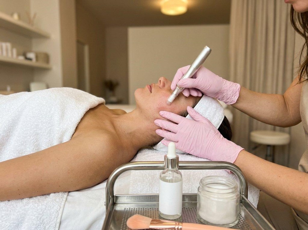 Foto 1 Regenera tu piel desde dentro: microneedling en Barakaldo